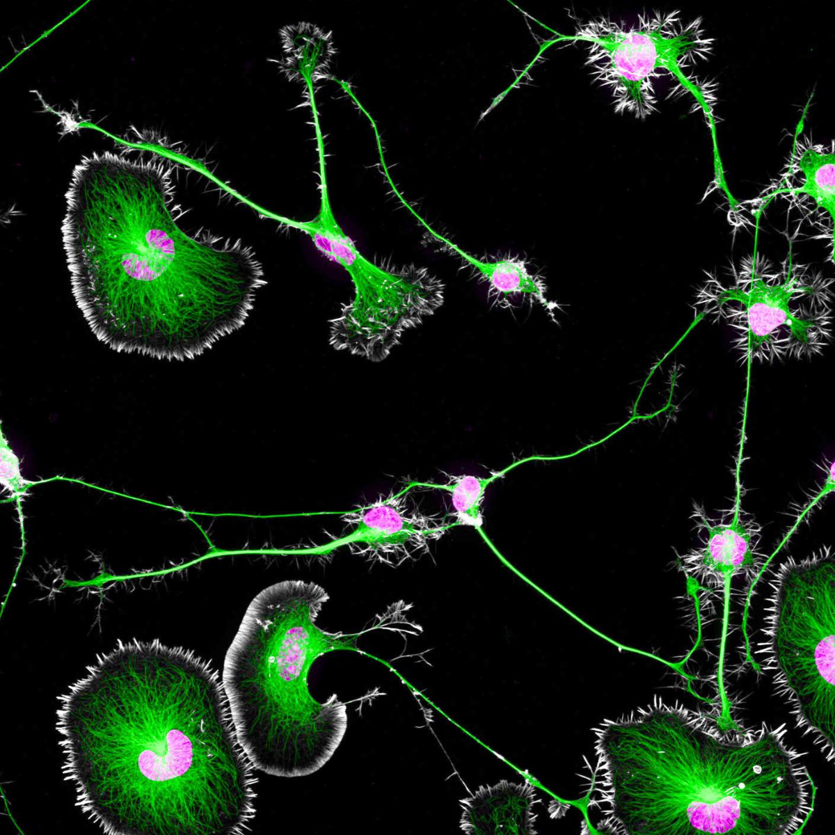 Differentiated mouse brain tumor cells